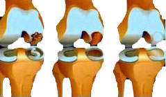 porckopás