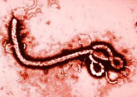 ebola vírus