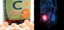 C-vitamin csökkentheti a vesekő kialakulását