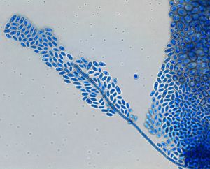 exophiala dermatitidis gomba
